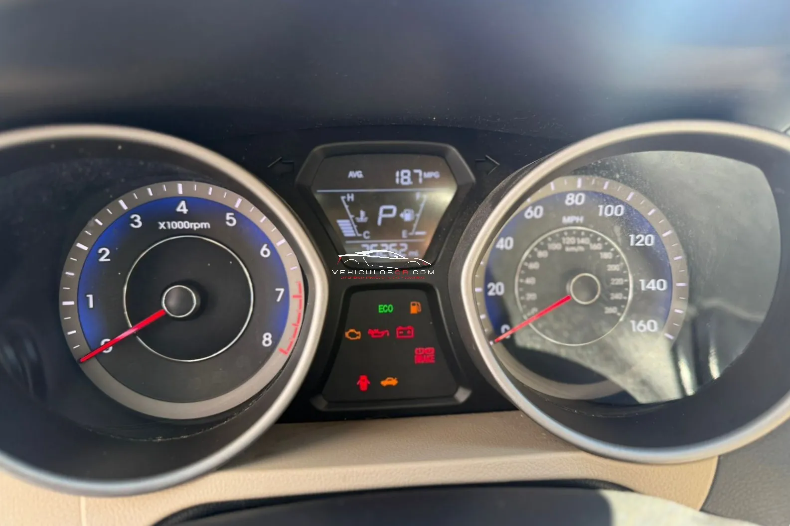 2015 HYUNDAI ELANTRA 2015 HYUNDAI ELANTRA - Imagen 15